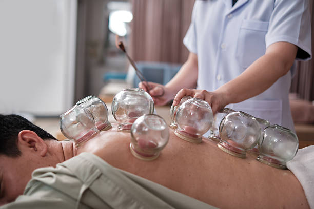 How Cupping & Dry Needling Accelerate Soft Tissue Healing